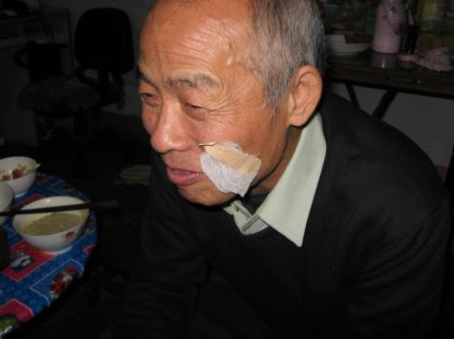 口腔潰瘍喝什麼茶水好
