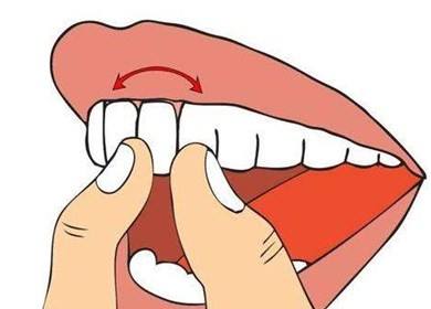 牙齒松動會自我修復嗎