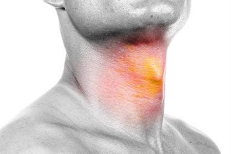 喉嚨痛是什麼原因