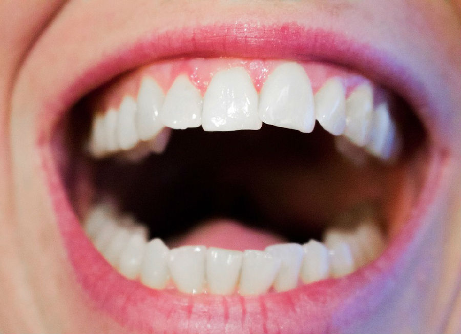 門牙牙齦萎縮怎麼辦