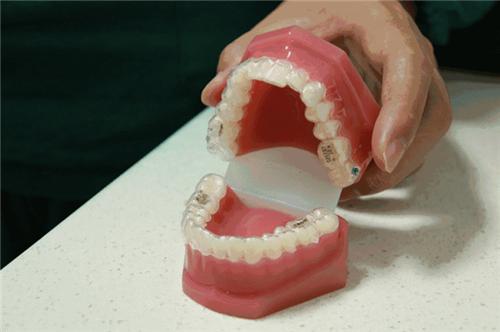 牙齒矯正的註意事項有哪些