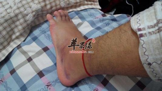 按摩可以消腫 來看看具體的方法