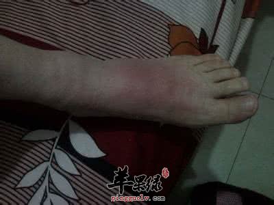 按摩可以消腫 來看看具體的方法
