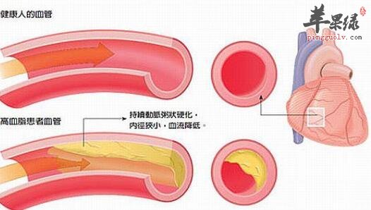 擴張外周血管的食物有哪些