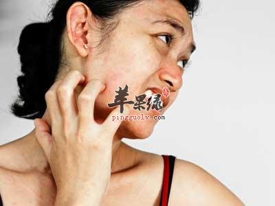 瞭解一些快速止癢的妙招
