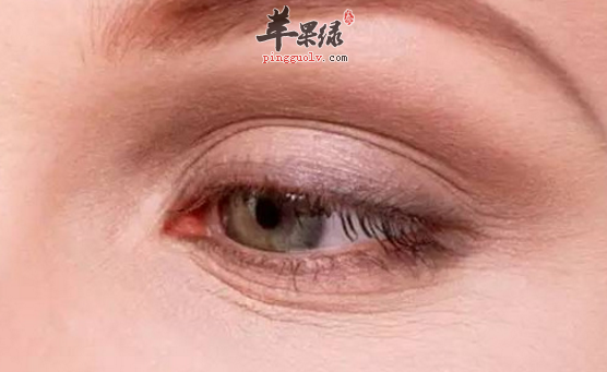 去除眼部細紋的正確方法講解