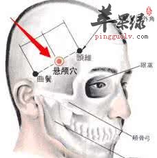 懸顱穴的位置 針灸懸顱穴治療頭痛