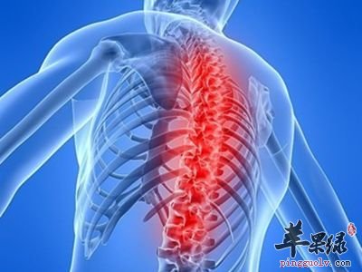 脊柱炎怎麼進行很好的緩解