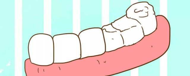 牙銀炎怎樣治療 三種治療方法分享
