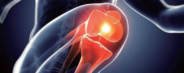 膝蓋韌帶損傷怎麼恢復 有這些治療原則