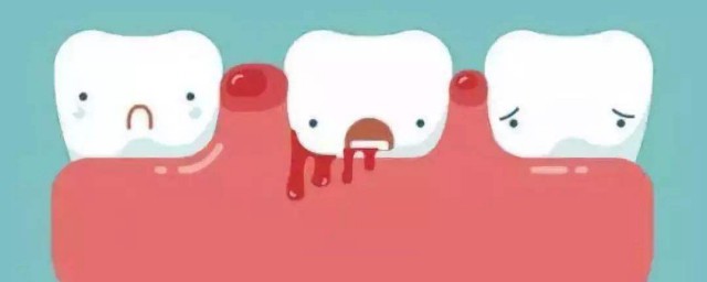 刷牙出血的原因及方法 怎麼處理牙齦出血的情況