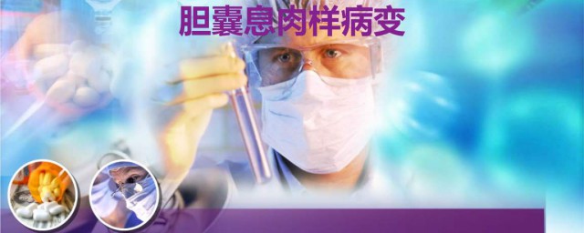 膽囊息肉大於1cm一定要切 排除病變可能