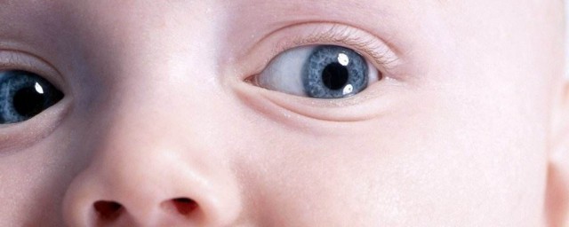 其實嬰幼兒眼睛腫是怎麼瞭 公開幾種導致眼睛腫的原因