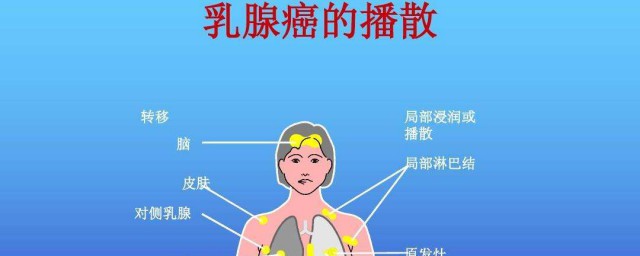 乳腺癌為什麼胳膊腫 手術後就一直會這樣嗎