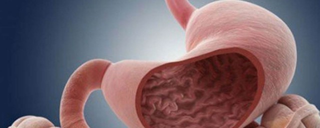 五十歲女人胃癌有啥癥狀 五大癥狀提示胃癌的早期