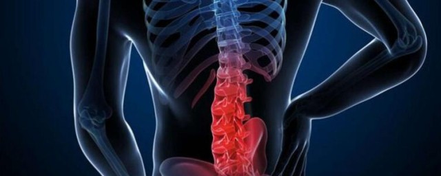 腰椎狹窄偏方分享 對病情恢復有著顯著作用