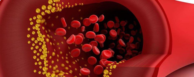 公開降血脂秘方 降血脂最好的8種方法