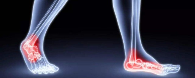如果腳踝外側疼怎麼辦 5種情況指導如何對癥治療