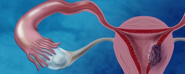 子宮頸抹片是什麼 一起來瞭解一下