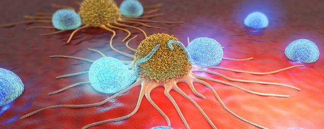 高分化和低分化的區別 癌細胞高分化和低分化的區別