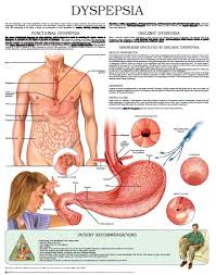 dyspepsia