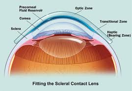 sclera