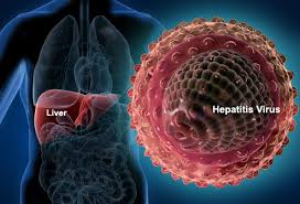 hepatitis