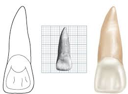 incisor