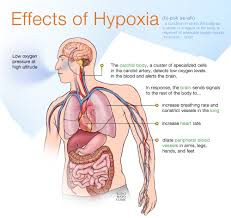 hypoxia