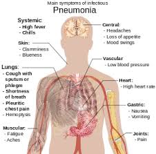 pneumonia