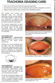 trachoma