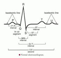 electrocardiogram