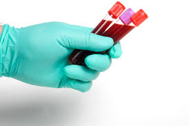 phlebotomy