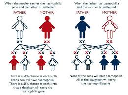 haemophilia