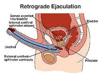 ejaculate