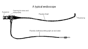 endoscope