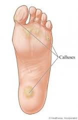 callus