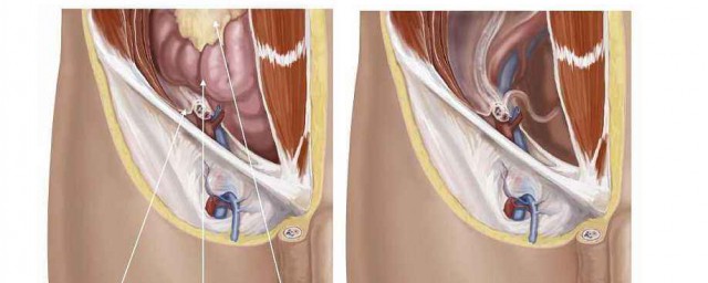 按摩腹股溝的作用 按摩腹股溝的作用有哪些