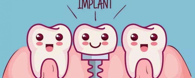 為何不建議做種植牙 良心醫生不建議種植牙的緣由