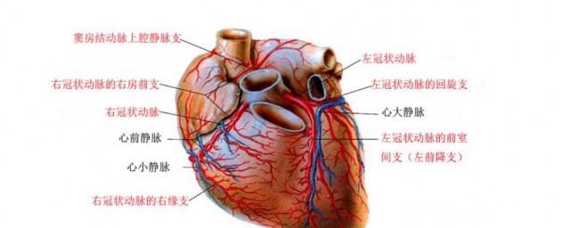 冠狀動脈鈣化嚴重嗎 冠狀動脈鈣化要緊嗎