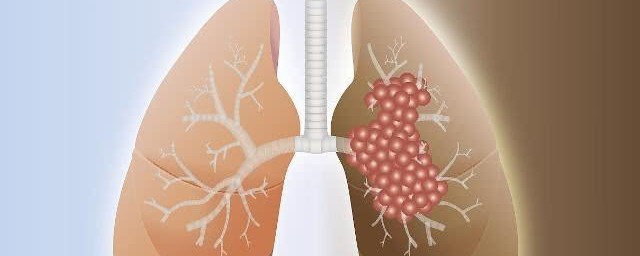 肺不好堅持養肺的三個方法 一定對養肺護肺有幫助