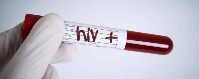HIV是什麼病 潛伏期多久