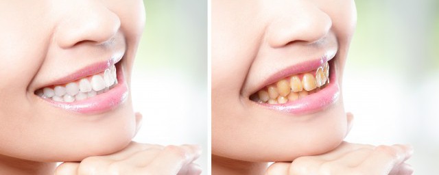 牙齒是什麼材質 牙齒的材質
